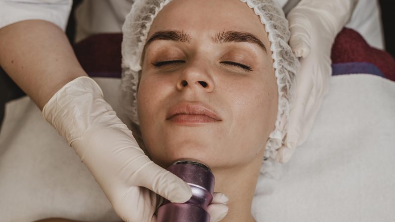 Microneedling and RF Treatments